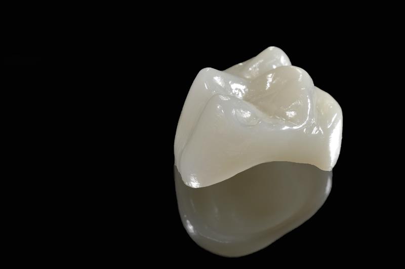Dental Crowns and Dental Bridges