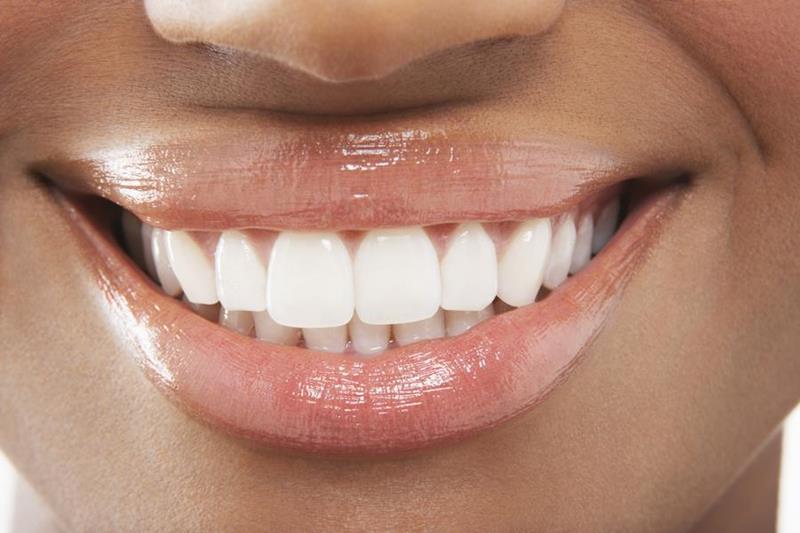 Tooth Extraction