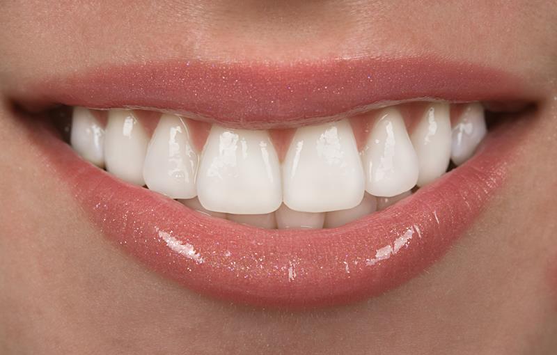 Smile Makeover