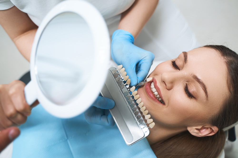 Dental Veneers and Dental Laminates